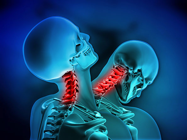 Are you worried that you might have a whiplash injury? Know the impacts