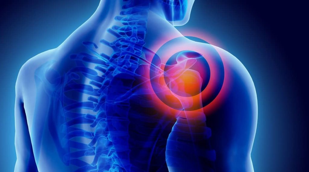 Work Benefits for Shoulder Injury | Henry Carus + Associates